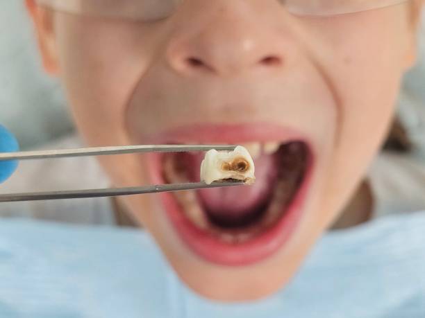 Best Emergency Pediatric Dentist  in Pine Ridge At Crestwood, NJ